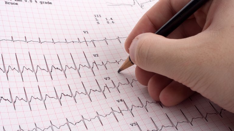 Ein Blatt mit EKG-Kurven, ein Arzt macht Notizen mit einem Bleistift darauf